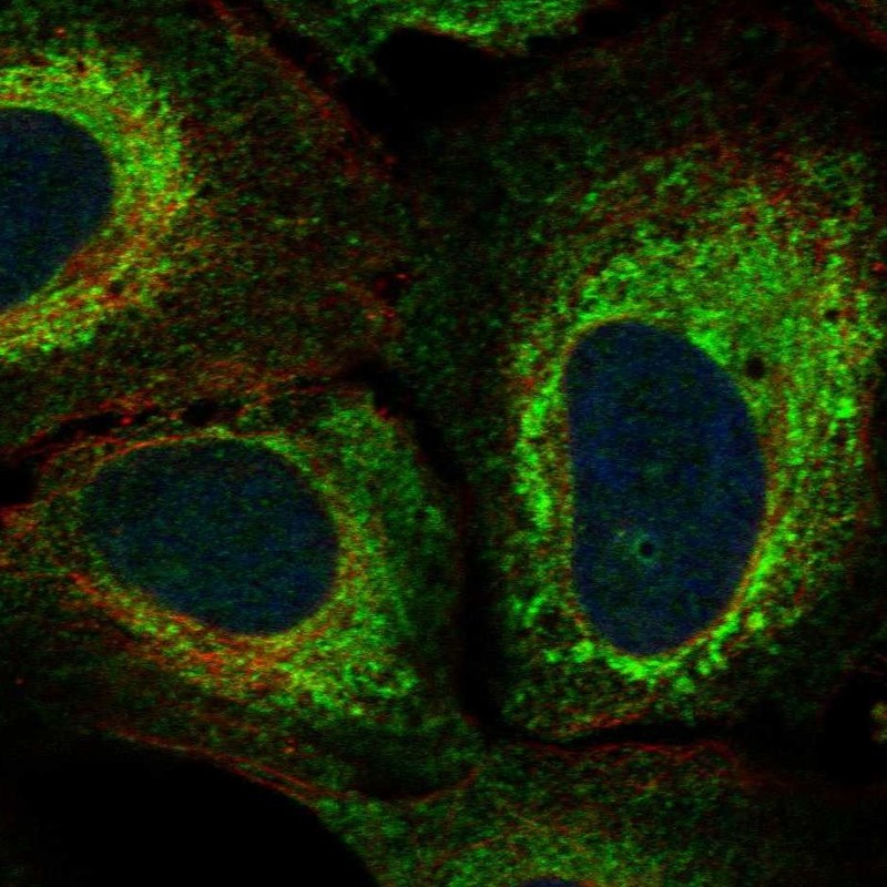 Anti-KIAA1324L Antibody