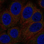 Anti-GPR89A Antibody