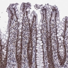 Anti-SNRPB2 Antibody