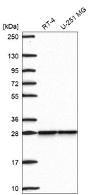 Western blot analysis in human cell line RT-4 and human cell line U-251 MG.