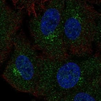 Anti-GALNT4 Antibody