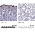 Anti-LOR Antibody