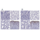 Immunohistochemical staining of human duodenum, kidney, prostate and skin using Anti-LOR antibody HPA076123 (A) shows similar protein distribution across tissues to independent antibody HPA077266 (B).