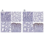 Immunohistochemical staining of human duodenum, kidney, prostate and skin using Anti-LOR antibody HPA076123 (A) shows similar protein distribution across tissues to independent antibody HPA077266 (B).