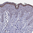 Anti-LOR Antibody