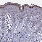 Immunohistochemical staining of human skin shows moderate to strong positivity in epidermal cells.