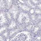 Immunohistochemical staining of human kidney shows no positivity in exocrine glandular cells as expected.
