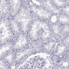 Immunohistochemical staining of human kidney shows no positivity in exocrine glandular cells as expected.