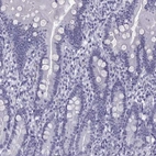 Immunohistochemical staining of human duodenum shows no positivity in glandular cells as expected.