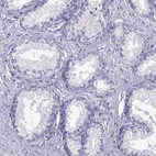 Immunohistochemical staining of human prostate shows no positivity in glandular cells as expected.