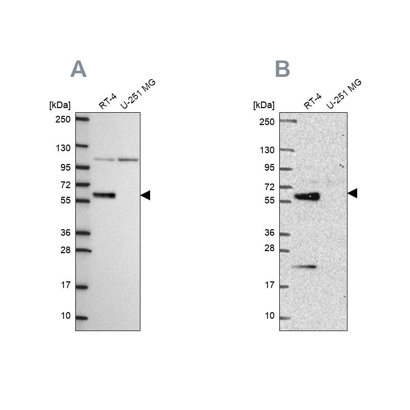Anti-IRF6 Antibody