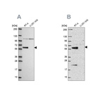 Anti-IRF6 Antibody