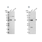 Anti-IRF6 Antibody