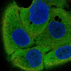 Immunofluorescent staining of human cell line HaCaT shows localization to cytosol.