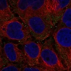 Anti-FANCD2OS Antibody