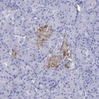 Immunohistochemical staining of human pancreas shows strong cytoplasmic positivity in islets of Langerhans.