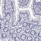 Immunohistochemical staining of human small intestine shows no positivity in glandular cells as expected.