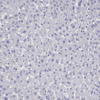 Anti-SLC30A8 Antibody