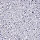 Immunohistochemical staining of human liver shows no positivity in hepatocytes as expected.