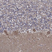 Anti-APBB3 Antibody
