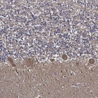 Anti-APBB3 Antibody