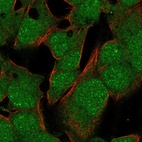 Anti-TBX10 Antibody