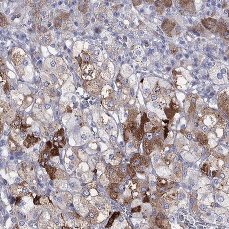 Anti-ARHGAP36 Antibody