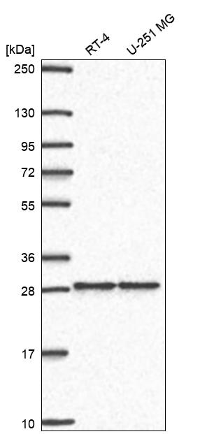 Anti-ZNF385A Antibody