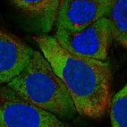 Immunofluorescent staining of human cell line HaCaT shows localization to cytosol.