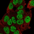 Immunofluorescent staining of human cell line OE19 shows localization to nucleoplasm.