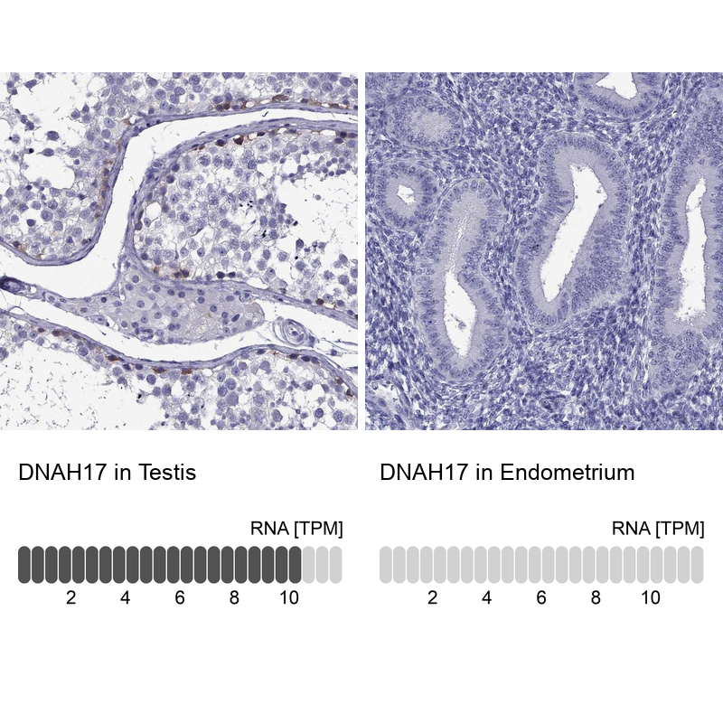 Anti-DNAH17 Antibody