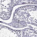 Immunohistochemical staining of human testis shows high expression.