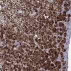 Anti-ZNF395 Antibody