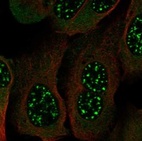 Immunofluorescent staining of human cell line U-2 OS shows localization to nuclear speckles & cytosol.