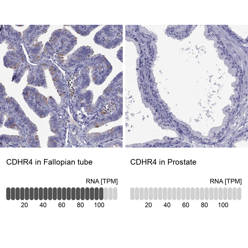 Anti-CDHR4 Antibody