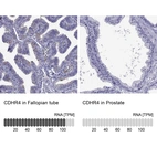 Anti-CDHR4 Antibody