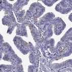 Immunohistochemical staining of human fallopian tube shows high expression.