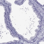 Immunohistochemical staining of human prostate shows low expression as expected.