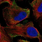 Anti-ADGRD1 Antibody