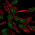 Immunofluorescent staining of human cell line AF22 shows localization to nucleoplasm & nucleoli fibrillar center.