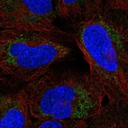 Anti-ARHGAP20 Antibody