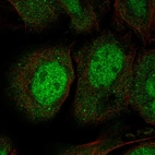 Anti-JPH3 Antibody