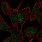 Anti-ASCL1 Antibody