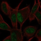 Anti-ASCL1 Antibody