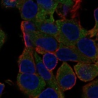 Anti-MOGAT1 Antibody