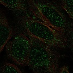 Anti-TCEAL2 Antibody