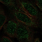 Anti-TCEAL2 Antibody