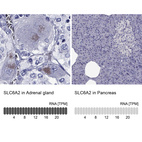 Anti-SLC6A2 Antibody