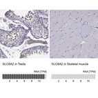 Anti-SLC6A2 Antibody