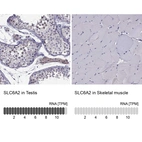 Anti-SLC6A2 Antibody